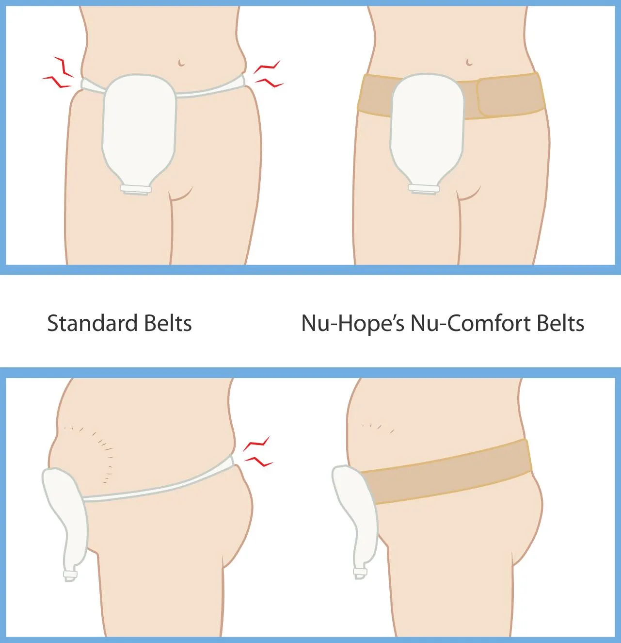 Nu-Comfort Belt for Ostomy and Hernia Support